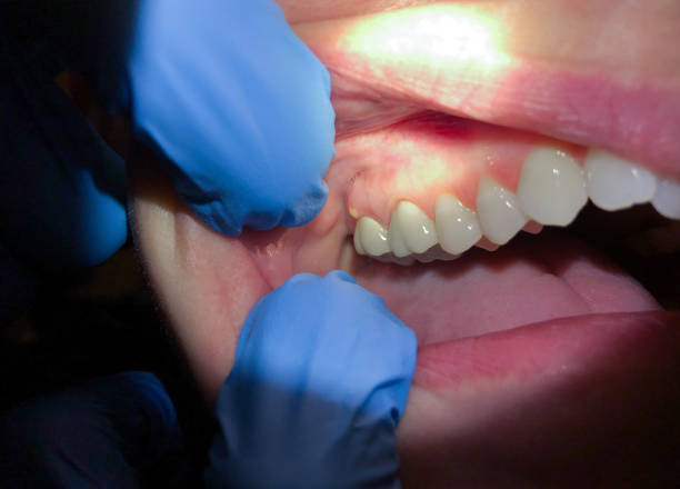 Best Orthodontic Emergency Dentist in Pacific, MO